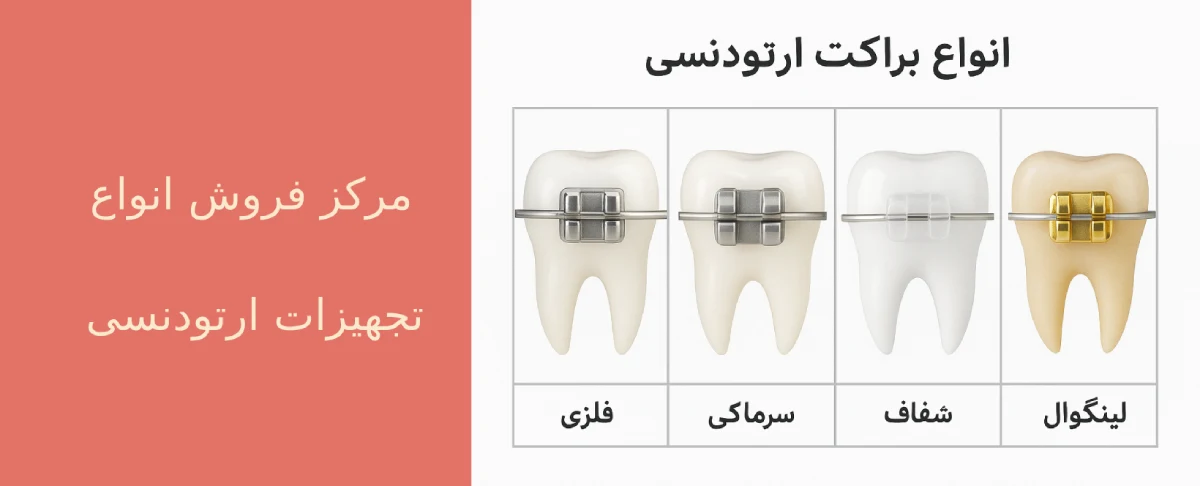 براکت ارتودنسی