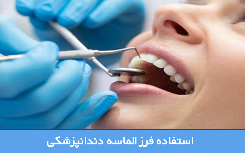 استفاده فرز الماسه دندانپزشکی